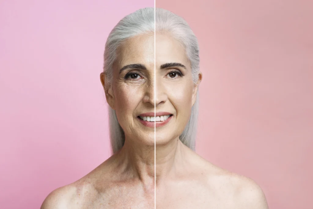 Anti-aging cilt bakım uygulaması